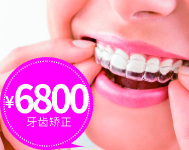 牙齒矯正6800元
